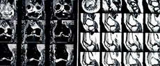 MEDICINA - I: Entram em cena os robôs cirurgiões